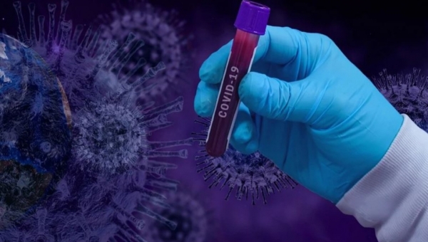 Casos diários de Covid-19 aumentam 400% em Cruzeiro do Sul